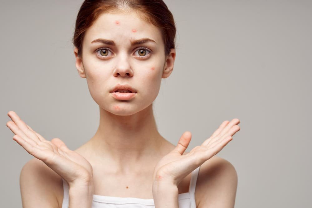 1   plasturi pentru cosuri